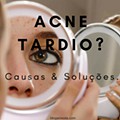 acne-tardio-causas-e-soluçoes-como-tratar-dicas-blogar-moda.png